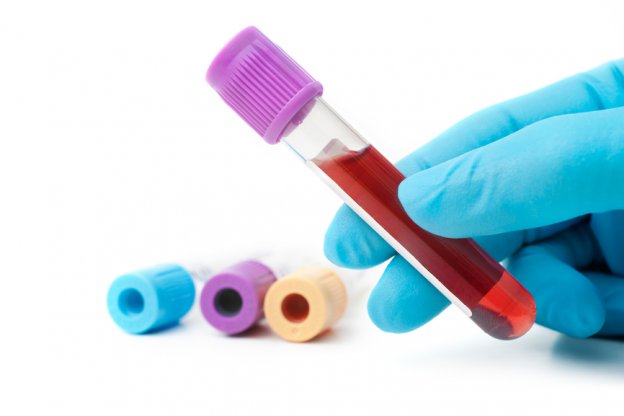 Blood tests for steroid users PHOTO