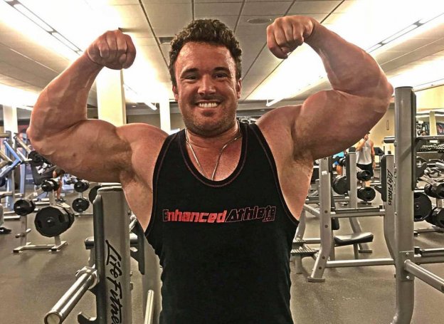 “Dan the Bodybuilder in Thailand” Requests Donations to Pay Medical Costs of Dirty Steroid Injection
